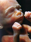 picture of fetus at 24 weeks