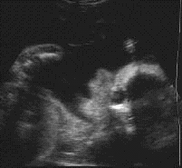 ultrasound 27 weeks