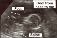 Peanut side view - feet and spine