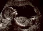 ultrasound at 16 weeks